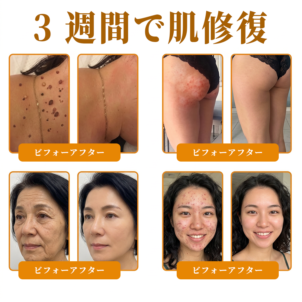 💎エイジング悩み対策サポート🐝🥇 𝖠𝖯𝖪𝖠𝖯𝖪® ハチ毒トータルスキンケアクリーム🔥