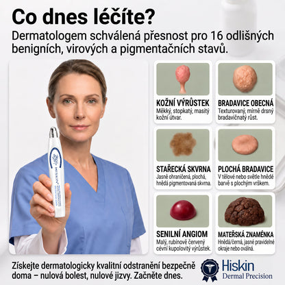 💎💎Oficiální značkový obchod | Hiskin® 7denní odstraňovač skvrn a pigmentových skvrn (Bezbolestný rollerball bez jizev)🐬