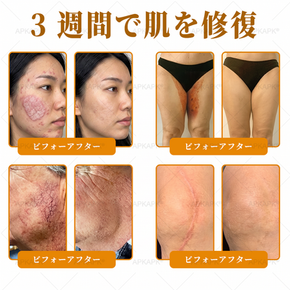 💎エイジング悩み対策サポート🐝🥇 𝖠𝖯𝖪𝖠𝖯𝖪® ハチ毒トータルスキンケアクリーム🔥