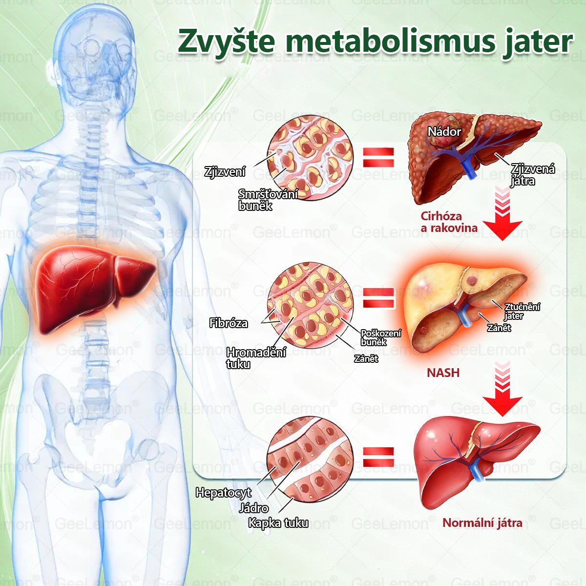 💥💥 𝐆𝐞𝑒𝑙𝑒𝐦𝐨𝐧® Glum𝐚𝐬𝐞tide 8 v 1 – Zeštíhlující nano mikrojihlový náplast 🇨🇿 Jen 1× denně ✅ Viditelné změny za 7 dní – na obezitu, kardiovaskulární zdraví, diabetes a kloubní problémy