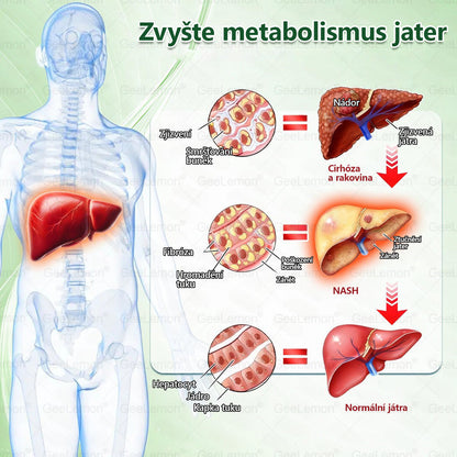 💥💥 𝐆𝐞𝑒𝑙𝑒𝐦𝐨𝐧® Glum𝐚𝐬𝐞tide 8 v 1 – Zeštíhlující nano mikrojihlový náplast 🇨🇿 Jen 1× denně ✅ Viditelné změny za 7 dní – na obezitu, kardiovaskulární zdraví, diabetes a kloubní problémy