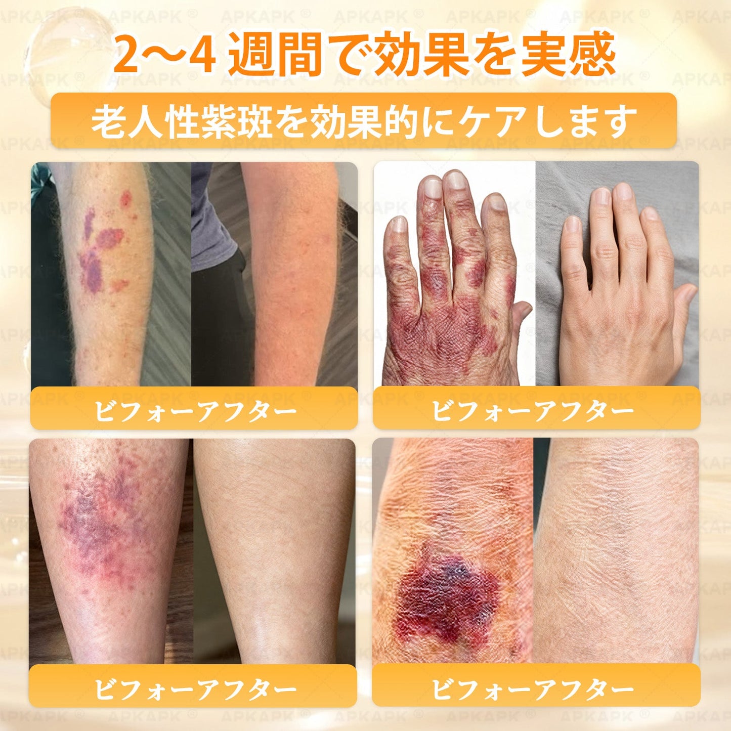 💎エイジング悩み対策サポート🐝🥇 𝖠𝖯𝖪𝖠𝖯𝖪® ハチ毒トータルスキンケアクリーム🔥