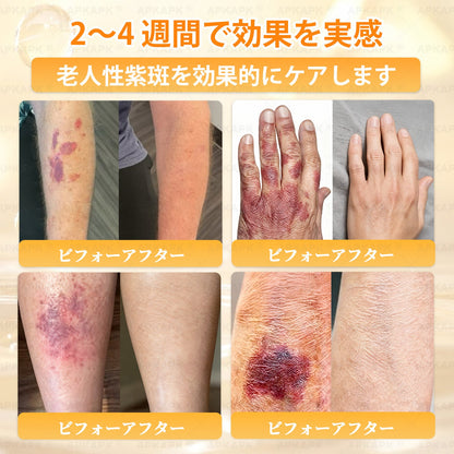 💎エイジング悩み対策サポート🐝🥇 𝖠𝖯𝖪𝖠𝖯𝖪® ハチ毒トータルスキンケアクリーム🔥