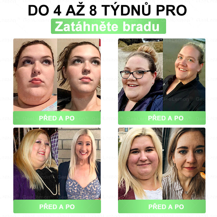 💥💥 𝐆𝐞𝑒𝑙𝑒𝐦𝐨𝐧® Glum𝐚𝐬𝐞tide 8 v 1 – Zeštíhlující nano mikrojihlový náplast 🇨🇿 Jen 1× denně ✅ Viditelné změny za 7 dní – na obezitu, kardiovaskulární zdraví, diabetes a kloubní problémy