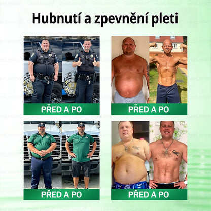 💥💥 𝐆𝐞𝑒𝑙𝑒𝐦𝐨𝐧® Glum𝐚𝐬𝐞tide 8 v 1 – Zeštíhlující nano mikrojihlový náplast 🇨🇿 Jen 1× denně ✅ Viditelné změny za 7 dní – na obezitu, kardiovaskulární zdraví, diabetes a kloubní problémy