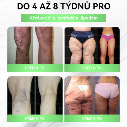 💥💥 𝐆𝐞𝑒𝑙𝑒𝐦𝐨𝐧® Glum𝐚𝐬𝐞tide 8 v 1 – Zeštíhlující nano mikrojihlový náplast 🇨🇿 Jen 1× denně ✅ Viditelné změny za 7 dní – na obezitu, kardiovaskulární zdraví, diabetes a kloubní problémy