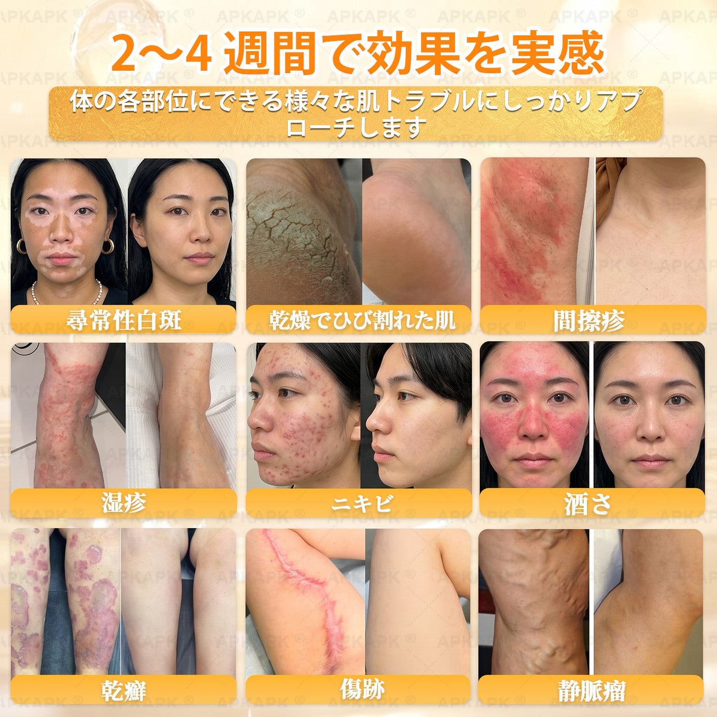 💎エイジング悩み対策サポート🐝🥇 𝖠𝖯𝖪𝖠𝖯𝖪® ハチ毒トータルスキンケアクリーム🔥
