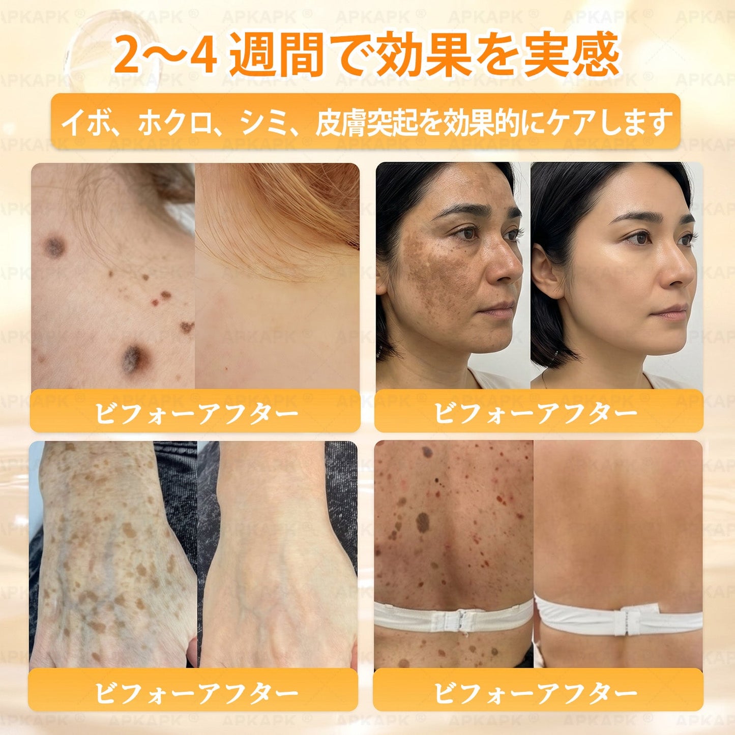 💎エイジング悩み対策サポート🐝🥇 𝖠𝖯𝖪𝖠𝖯𝖪® ハチ毒トータルスキンケアクリーム🔥
