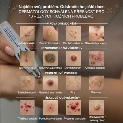 💎💎Oficiální značkový obchod | Hiskin® 7denní odstraňovač skvrn a pigmentových skvrn (Bezbolestný rollerball bez jizev)🐬