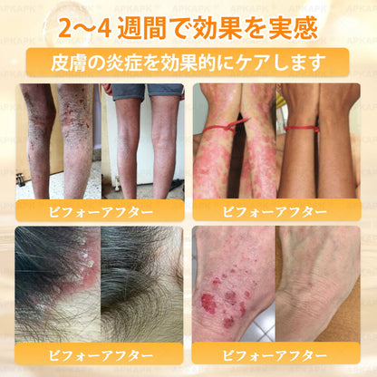 💎エイジング悩み対策サポート🐝🥇 𝖠𝖯𝖪𝖠𝖯𝖪® ハチ毒トータルスキンケアクリーム🔥