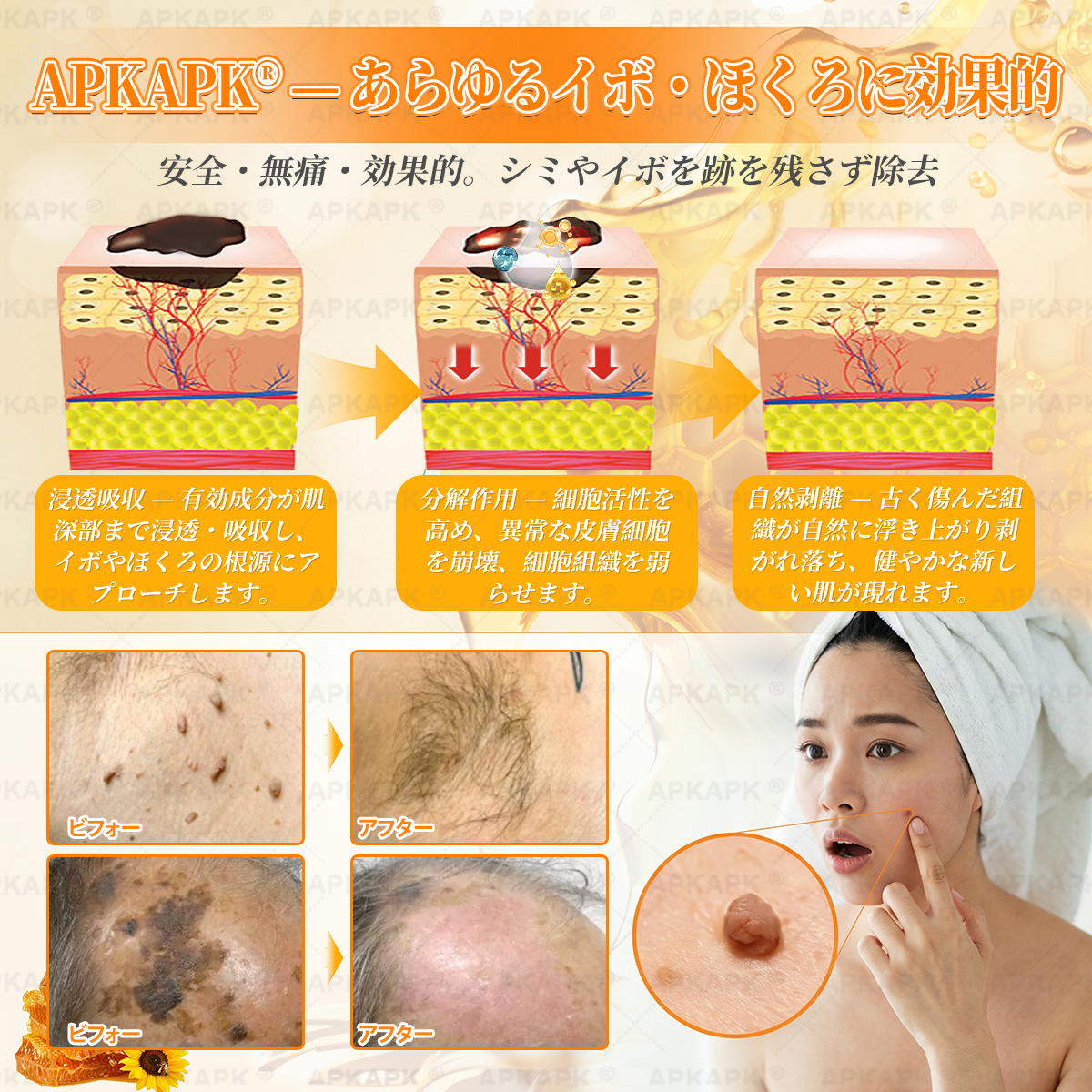 💎エイジング悩み対策サポート🐝🥇 𝖠𝖯𝖪𝖠𝖯𝖪® ハチ毒トータルスキンケアクリーム🔥